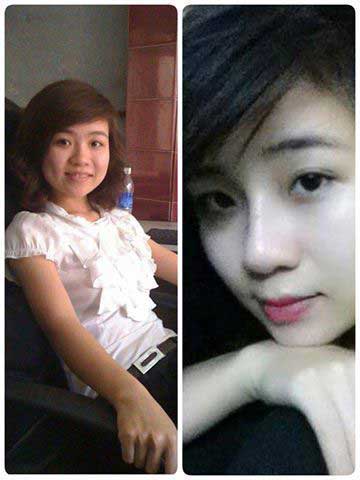 Thu gọn cánh mũi
