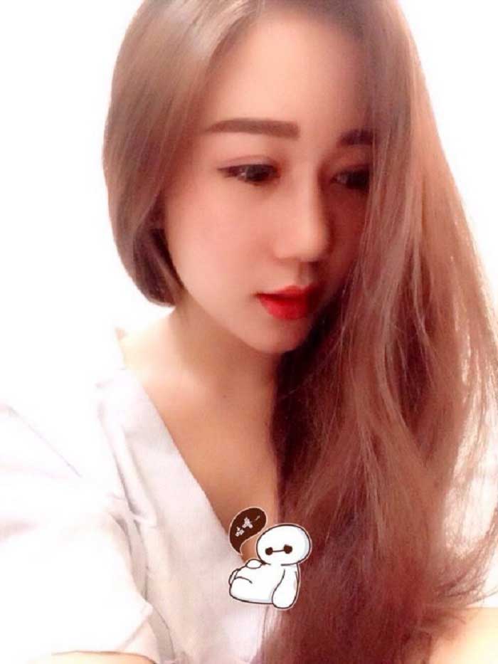 Cắt mí mắt