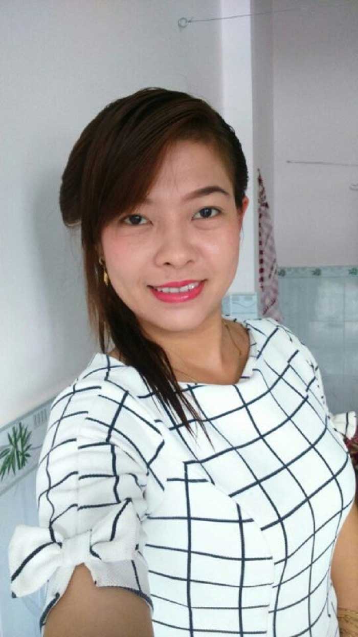 Cắt mí mắt