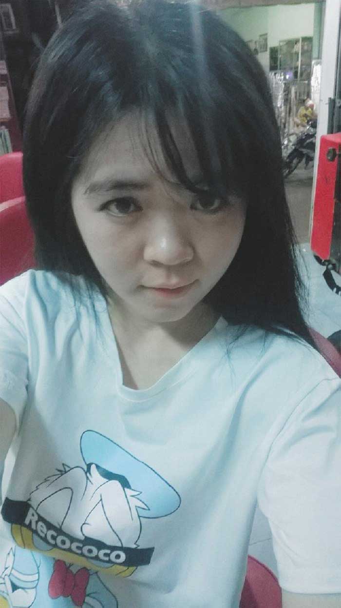 Nâng mũi Hàn Quốc