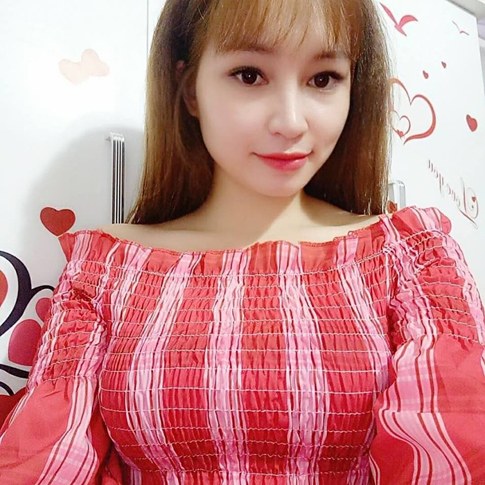 Nâng mũi bọc sụn