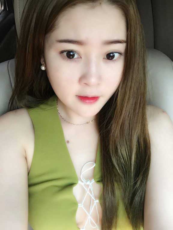 Nâng mũi S Line