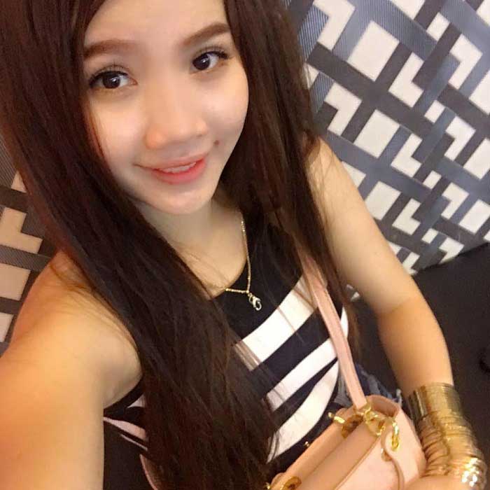 Nâng mũi bọc sụn
