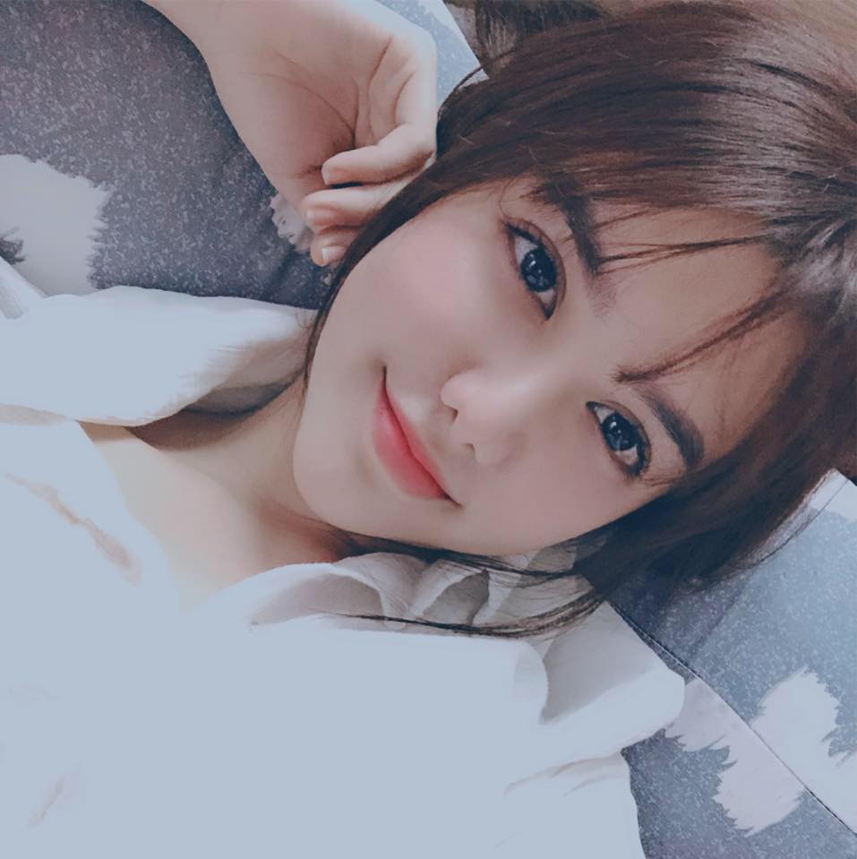 Cắt mí mắt