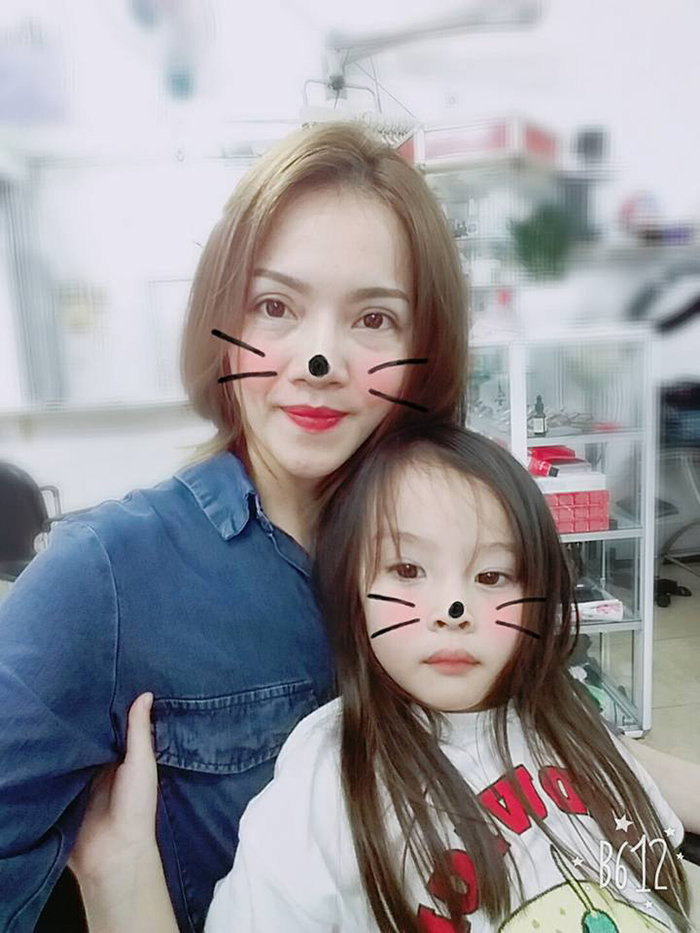 Cắt mí mắt