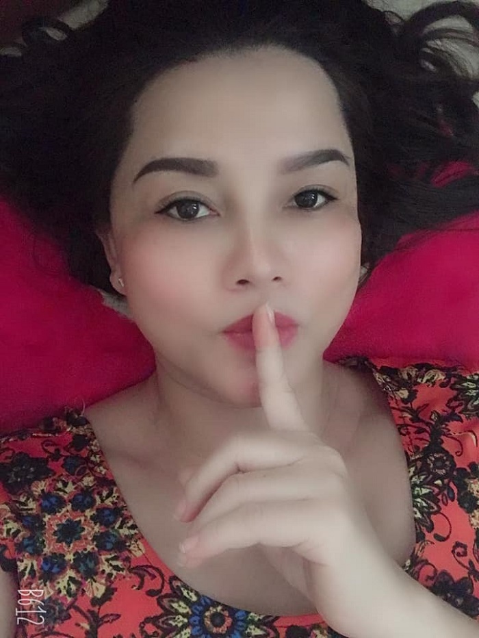 Nâng mũi bọc sụn