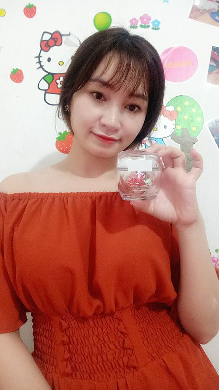 Nâng mũi bọc sụn