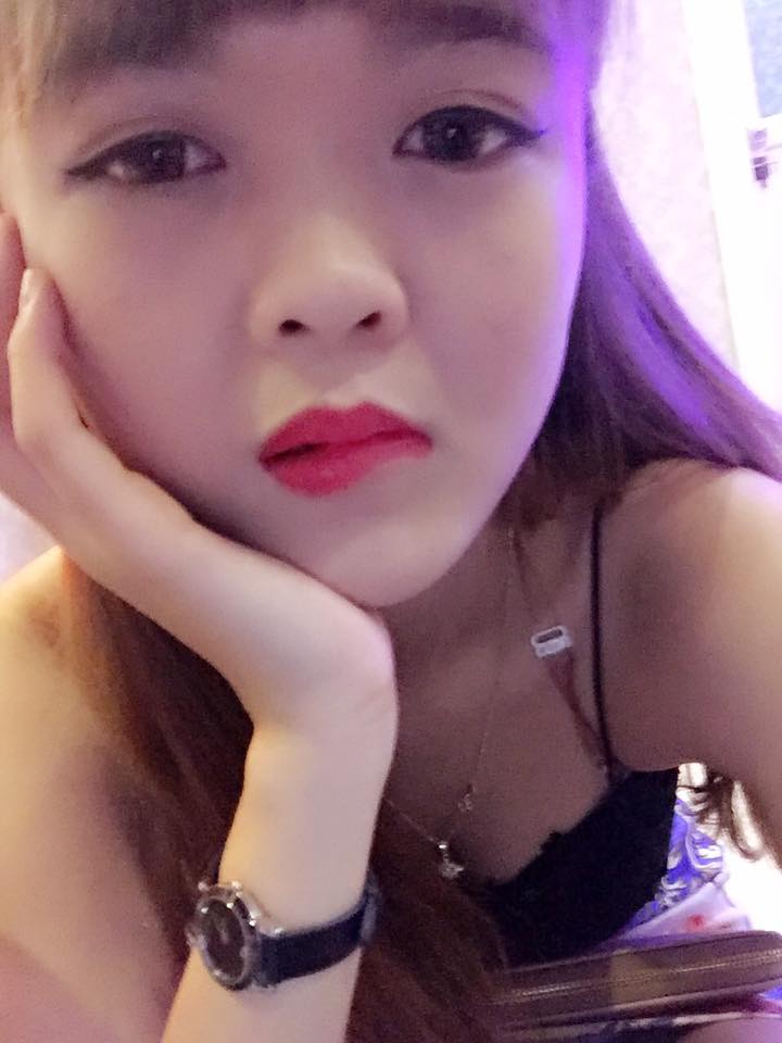 Nâng mũi bọc sụn