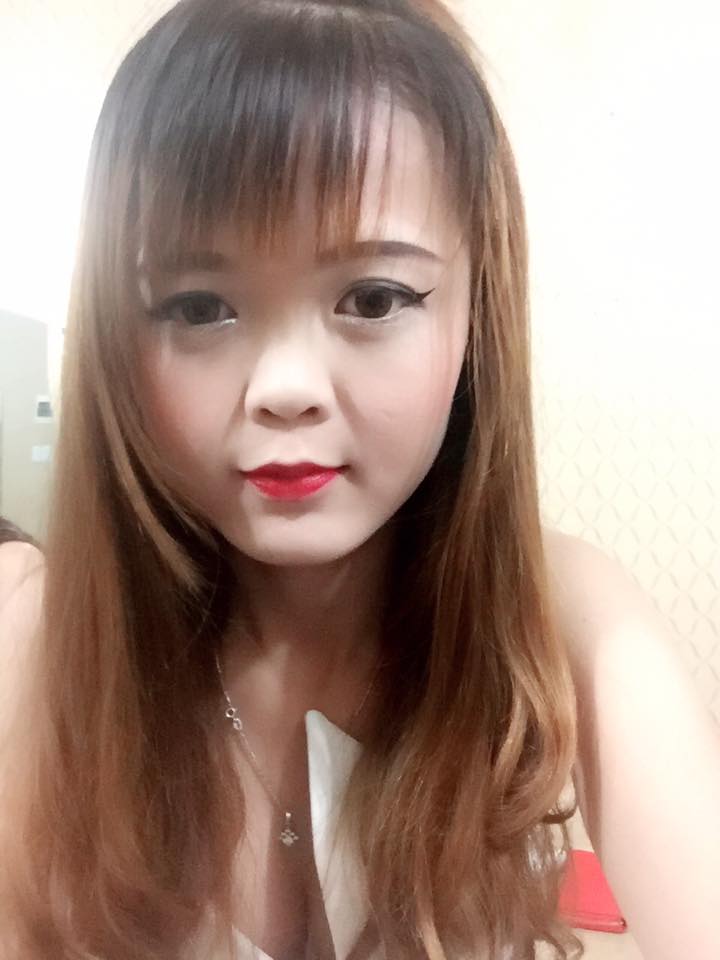 Nâng mũi bọc sụn