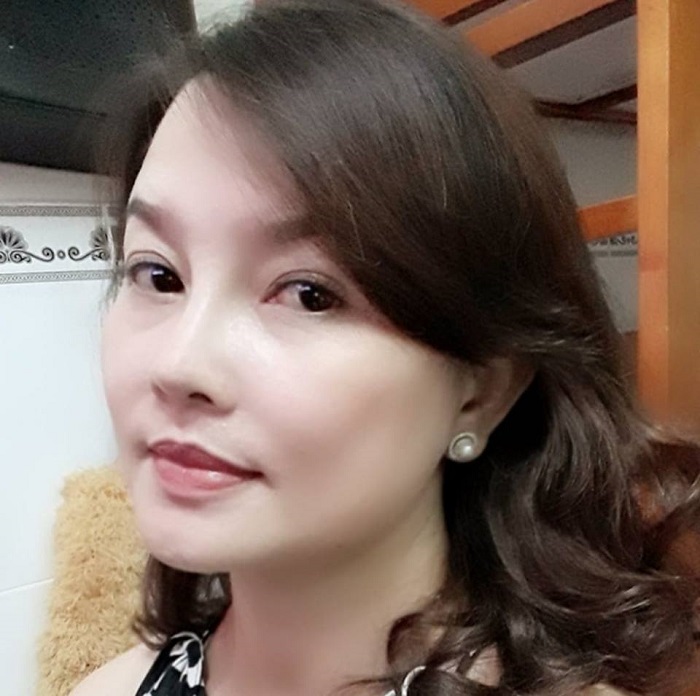 Nâng mũi bọc sụn