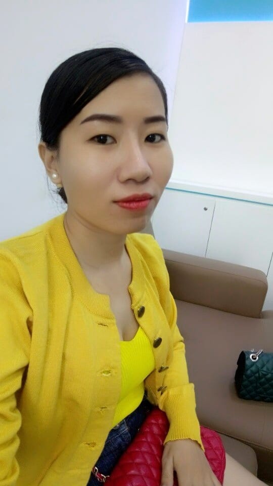 Nâng mũi Hàn Quốc