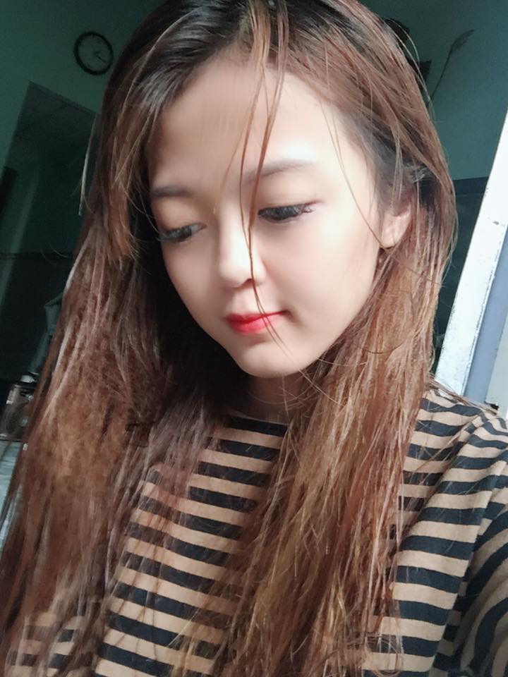 Nâng mũi bọc sụn