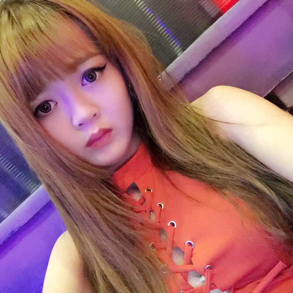 Nâng mũi bọc sụn