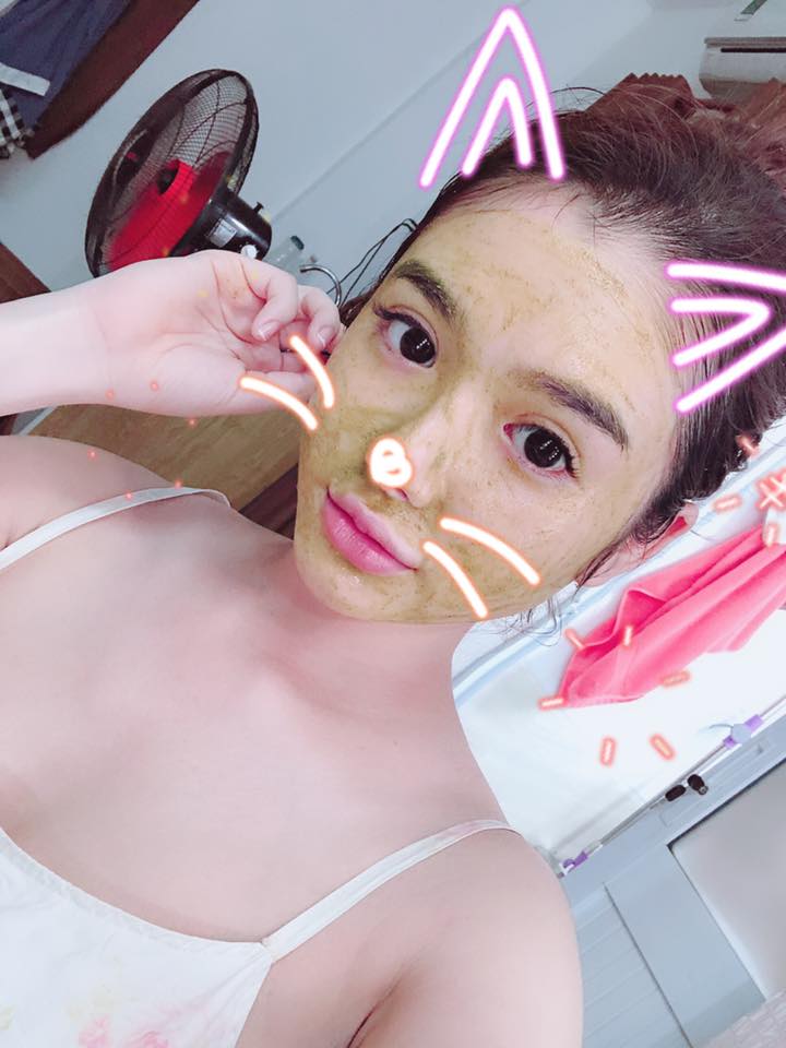 Cắt mí mắt