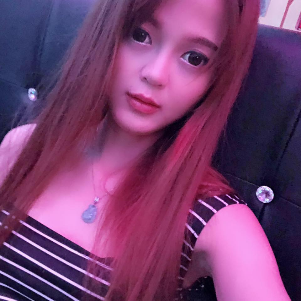 Nâng mũi bọc sụn
