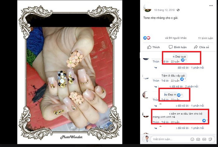 Nâng mũi bọc sụn