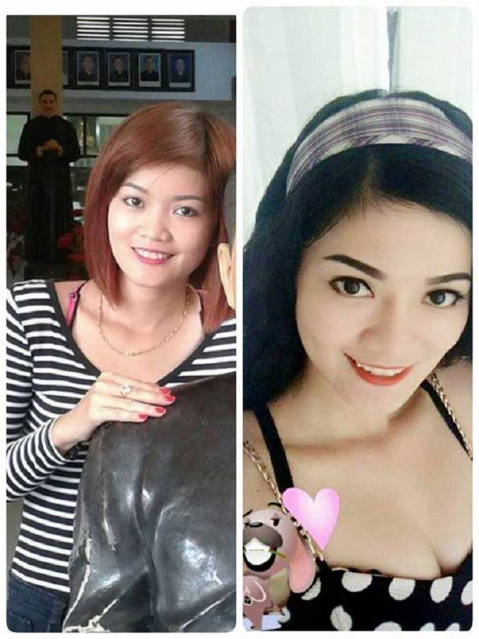 Má lúm đồng tiền