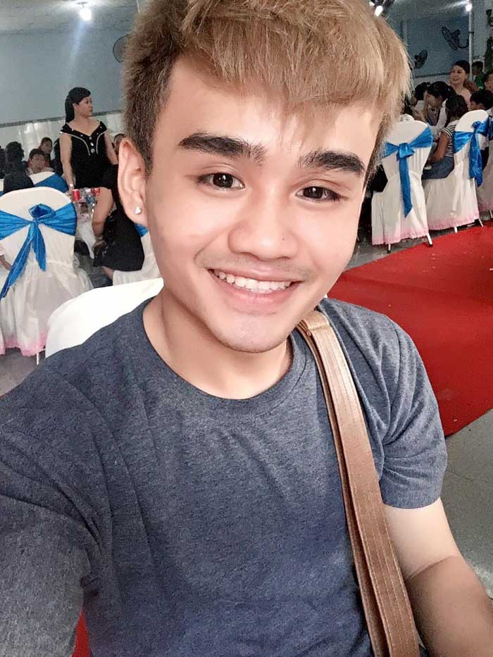 Nâng mũi bọc sụn