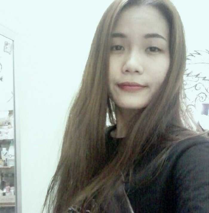 Nâng mũi bọc sụn