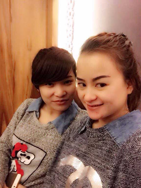 Độn cằm