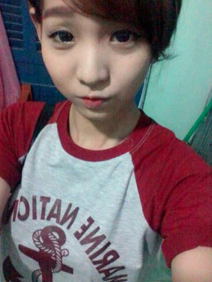 Nâng ngực nội soi