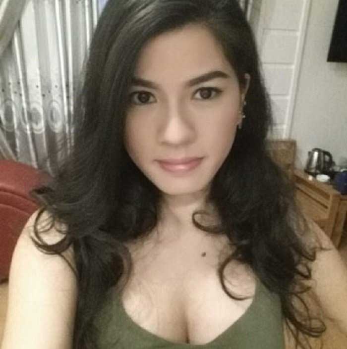 Lấy mỡ má