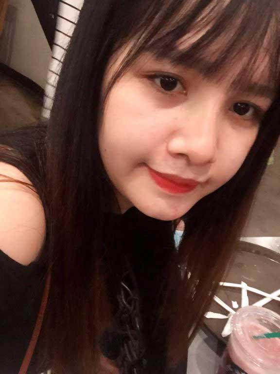 Nâng mũi S Line