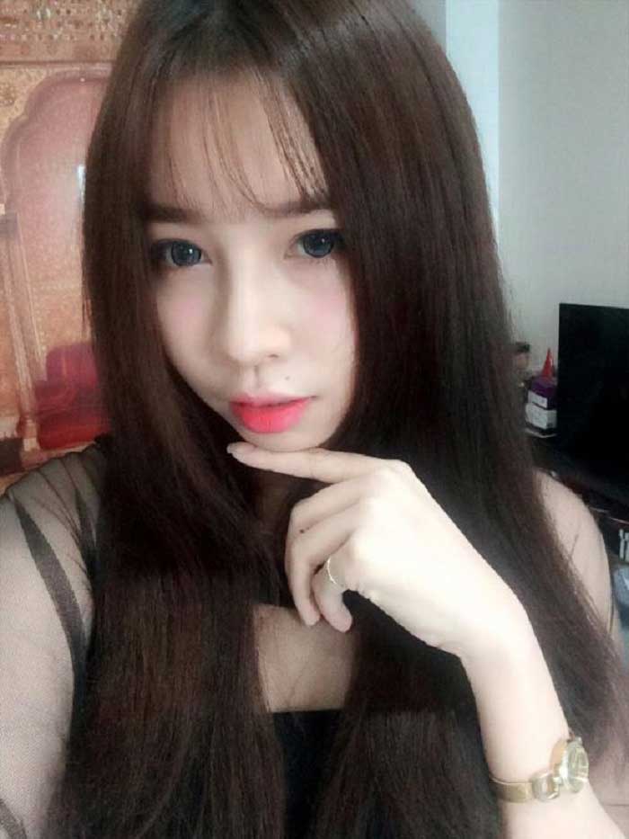 Nâng mũi bọc sụn