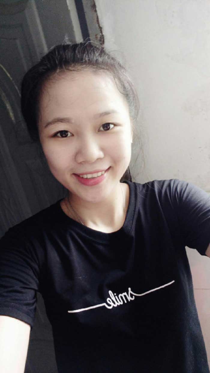 Nâng mũi bọc sụn
