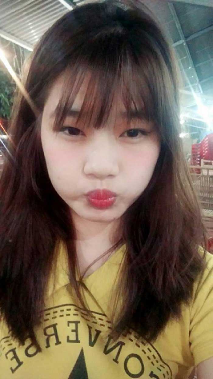 Cắt mí mắt