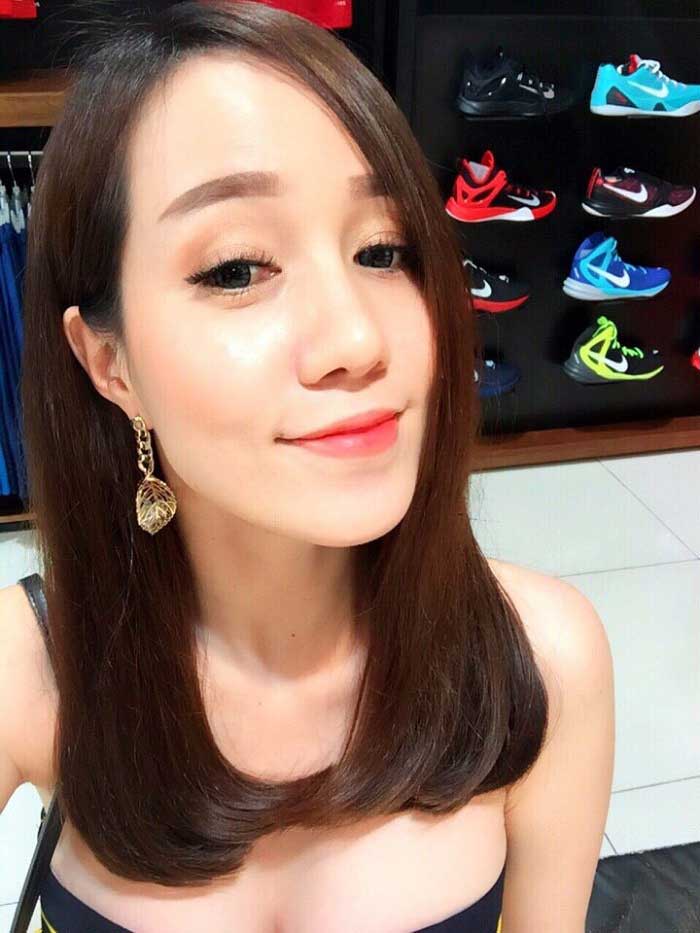 Cắt mí mắt
