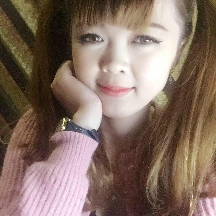 Nâng mũi bọc sụn