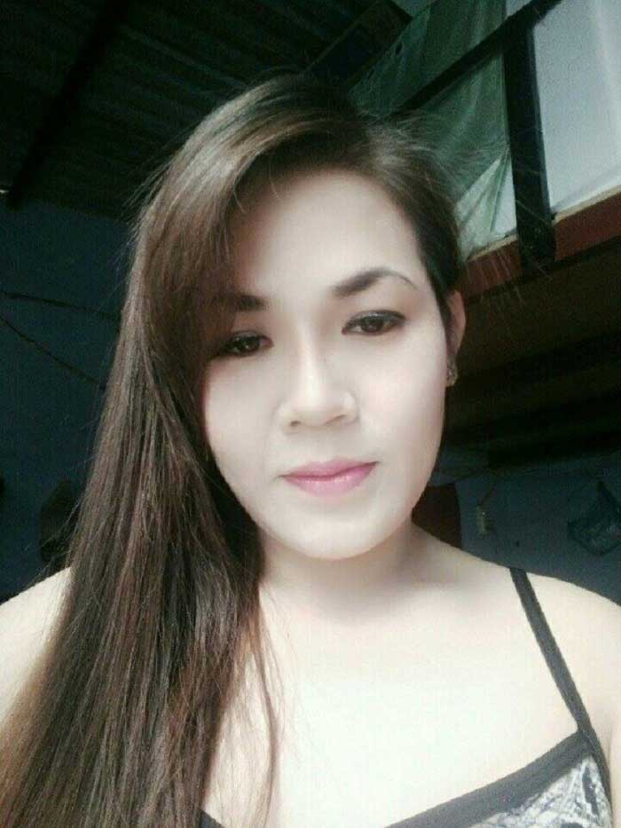 Nâng mũi bọc sụn