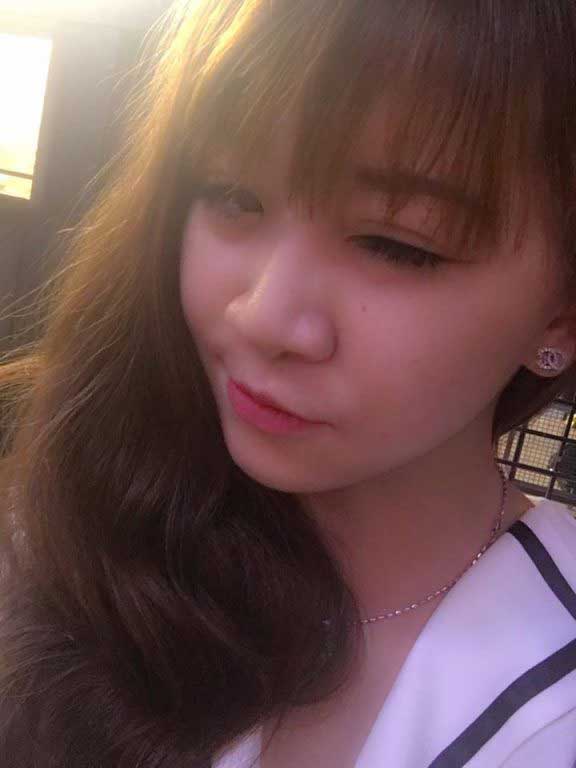 Bấm mí Hàn Quốc