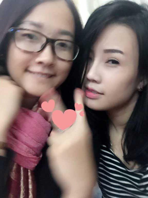 Bấm mí Hàn Quốc
