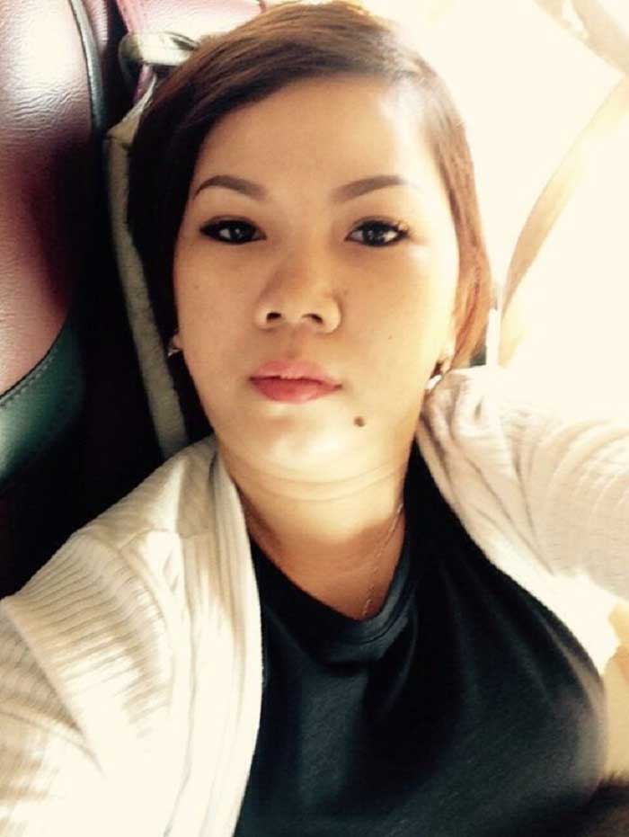 Cắt mí mắt