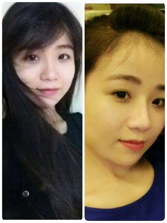 Thu gọn cánh mũi