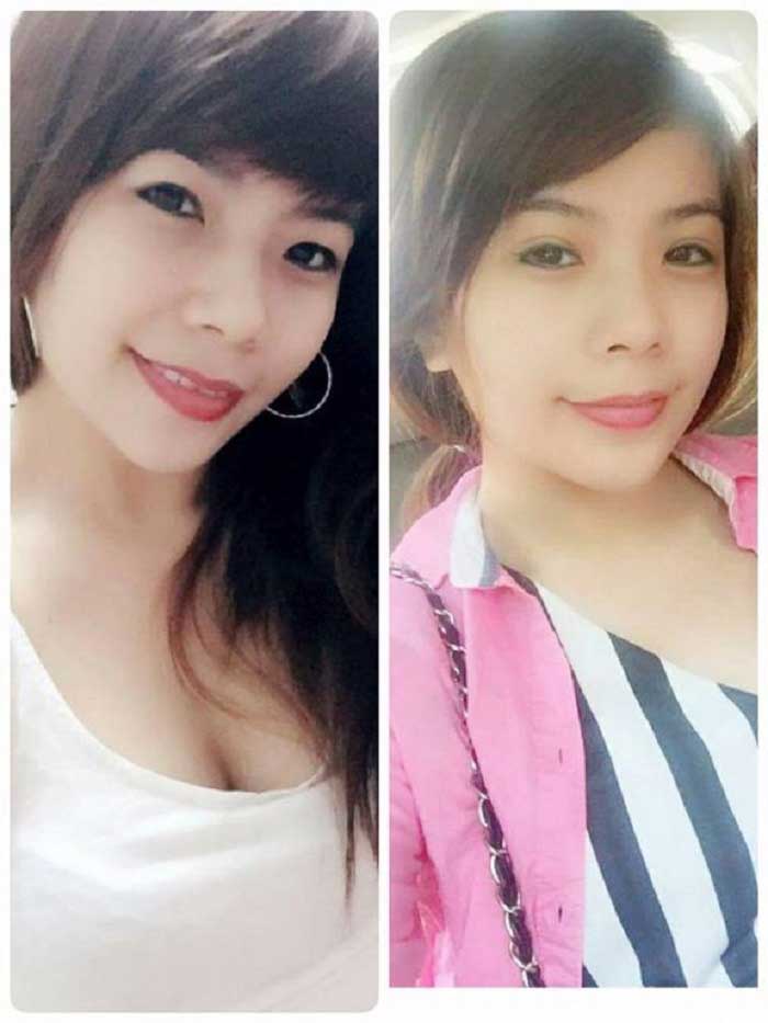 Cắt mí mắt