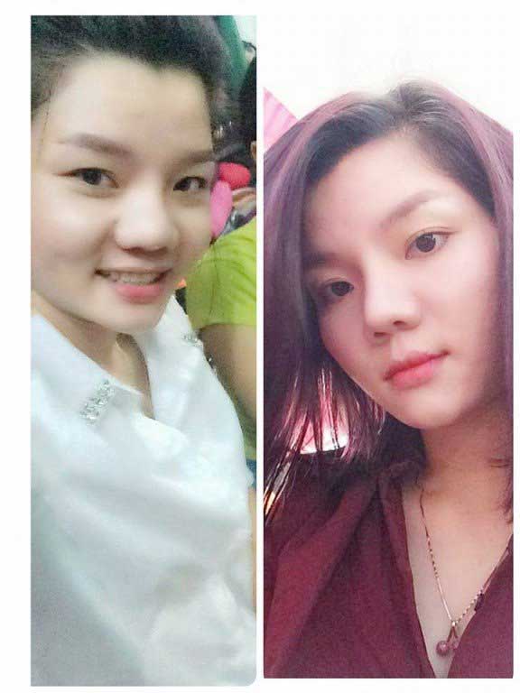 Thu gọn cánh mũi