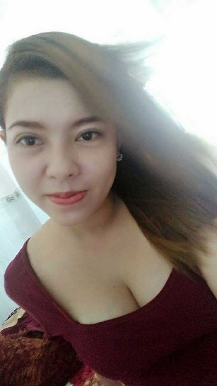 Cắt mí mắt