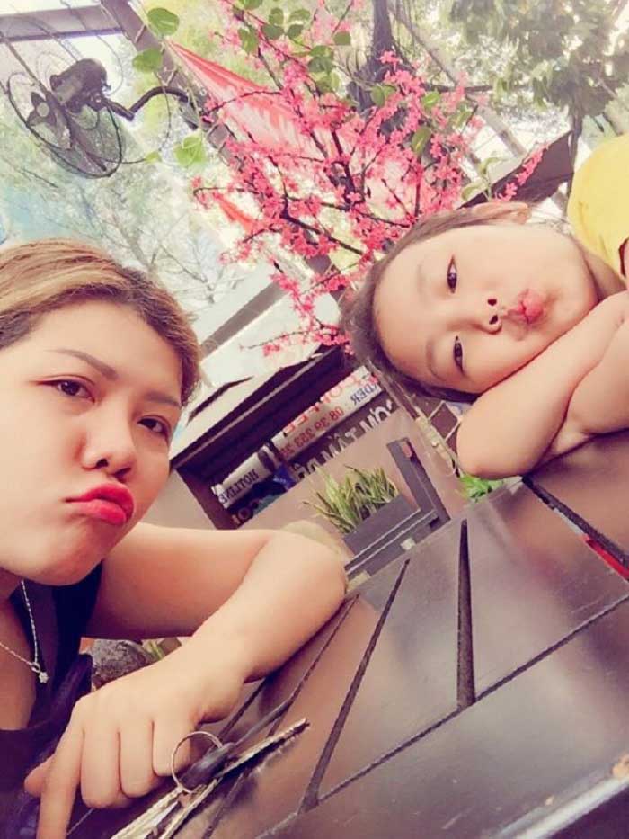 Cắt mí mắt