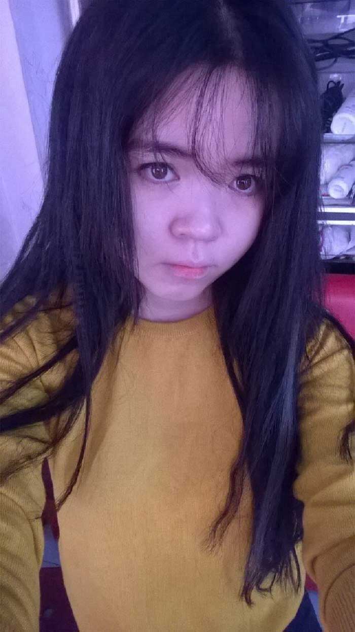 Nâng mũi Hàn Quốc