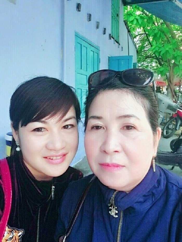 Cắt mí mắt