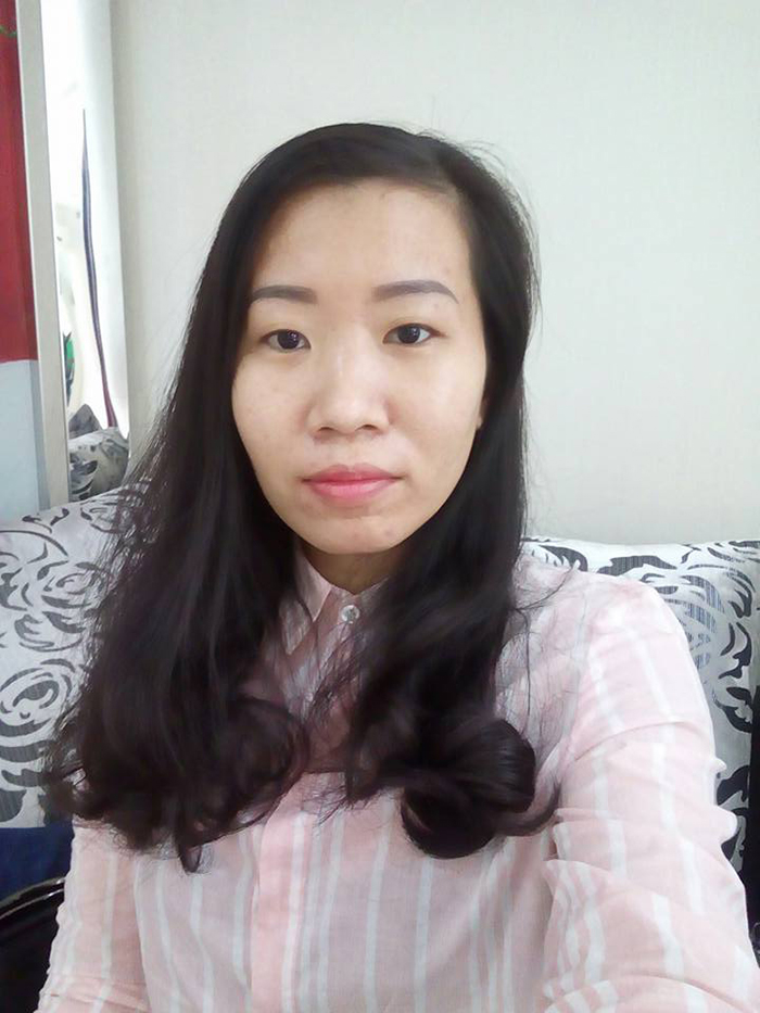 Nâng mũi Hàn Quốc