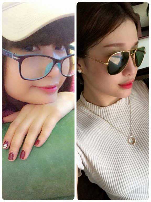 Độn cằm Độn cằm