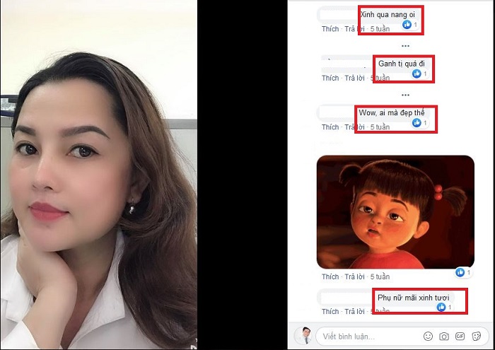 Nâng mũi bọc sụn
