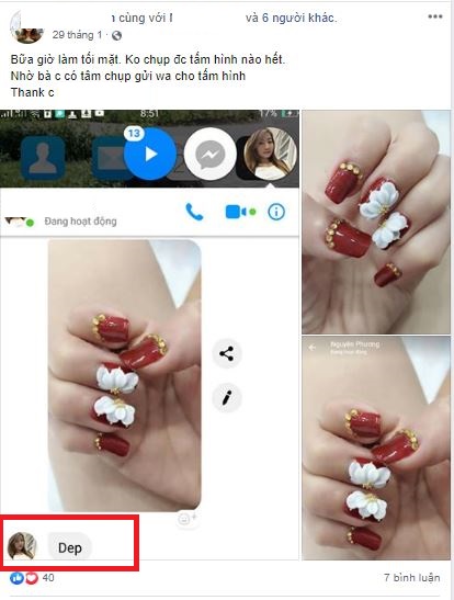 Nâng mũi bọc sụn