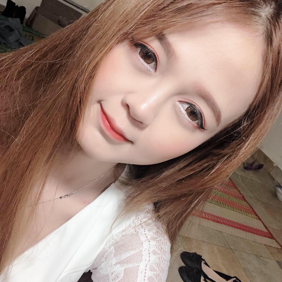 Nâng mũi bọc sụn