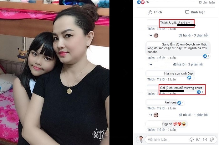 Nâng mũi bọc sụn