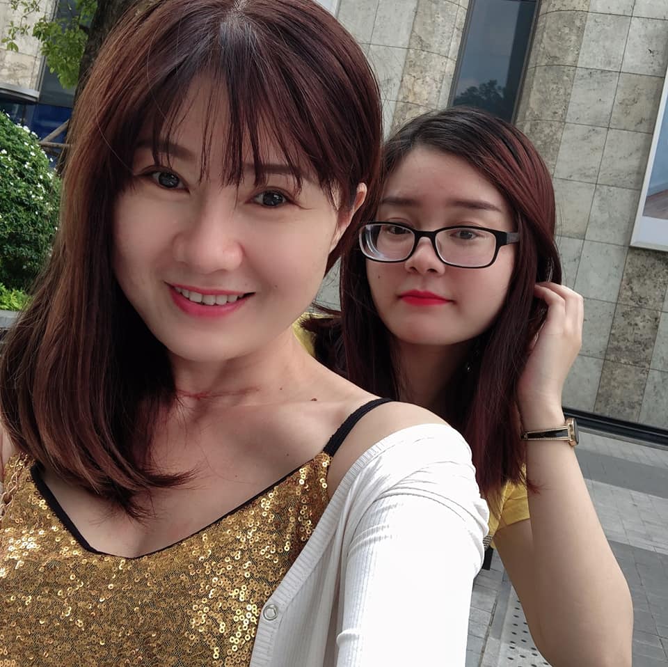 Mở rộng góc mắt